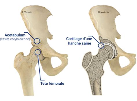 traduction hip|hanches f hip joint.